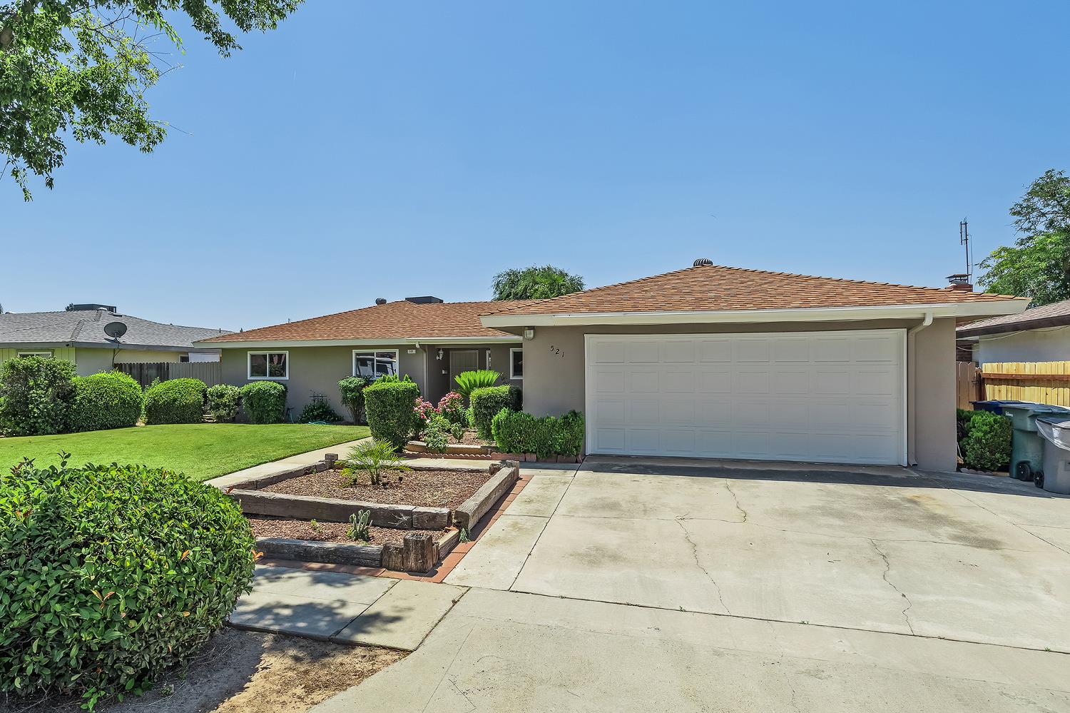521 E Escalon Avenue - Photo 2