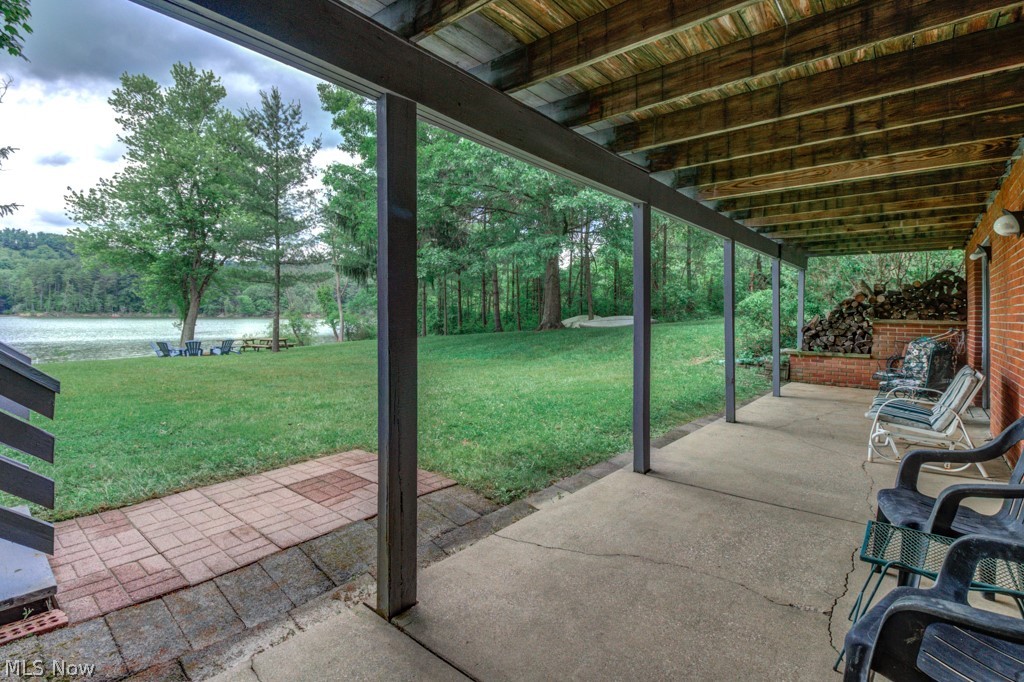 Atwood Lake - Residential