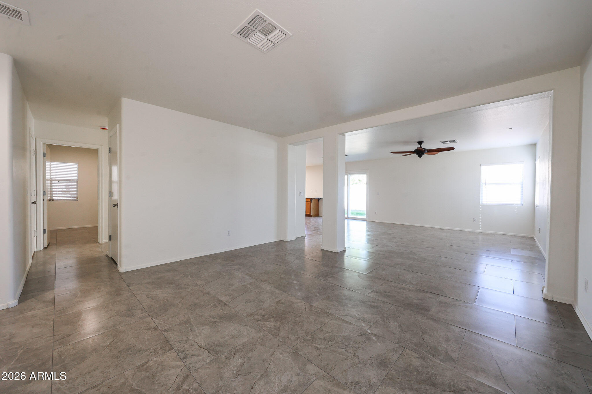 11538 W VOGEL Avenue