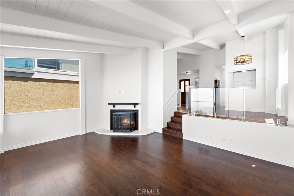 Arch Beach Heights (ABH) - Residential Lease