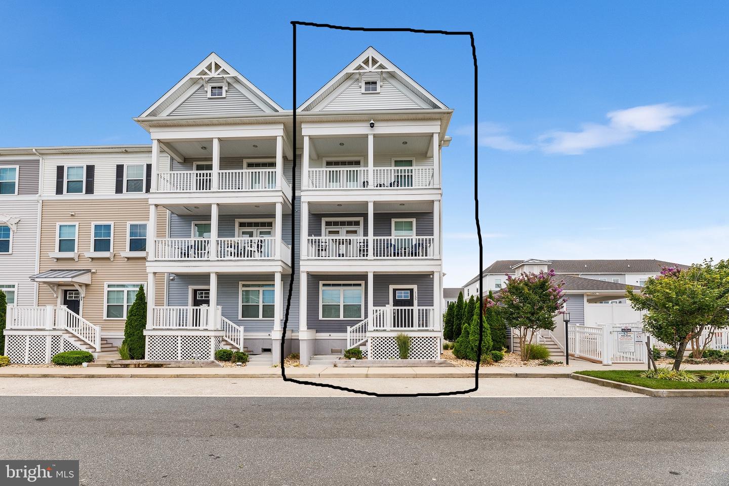 Photo 4 of 59 of 115 70th St #D townhome