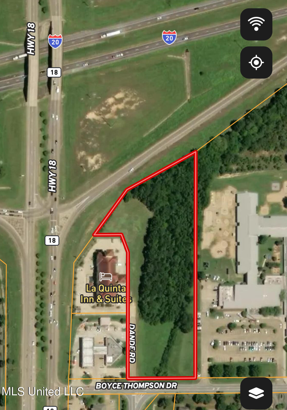 000 Boyce Thompson Drive, Brandon, Mississippi image 2