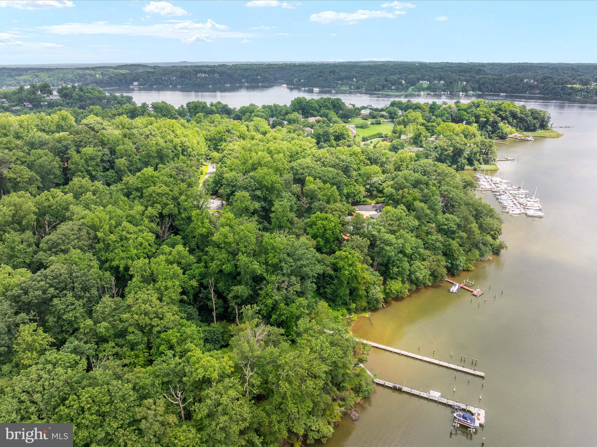 THE DOWNS - Residential