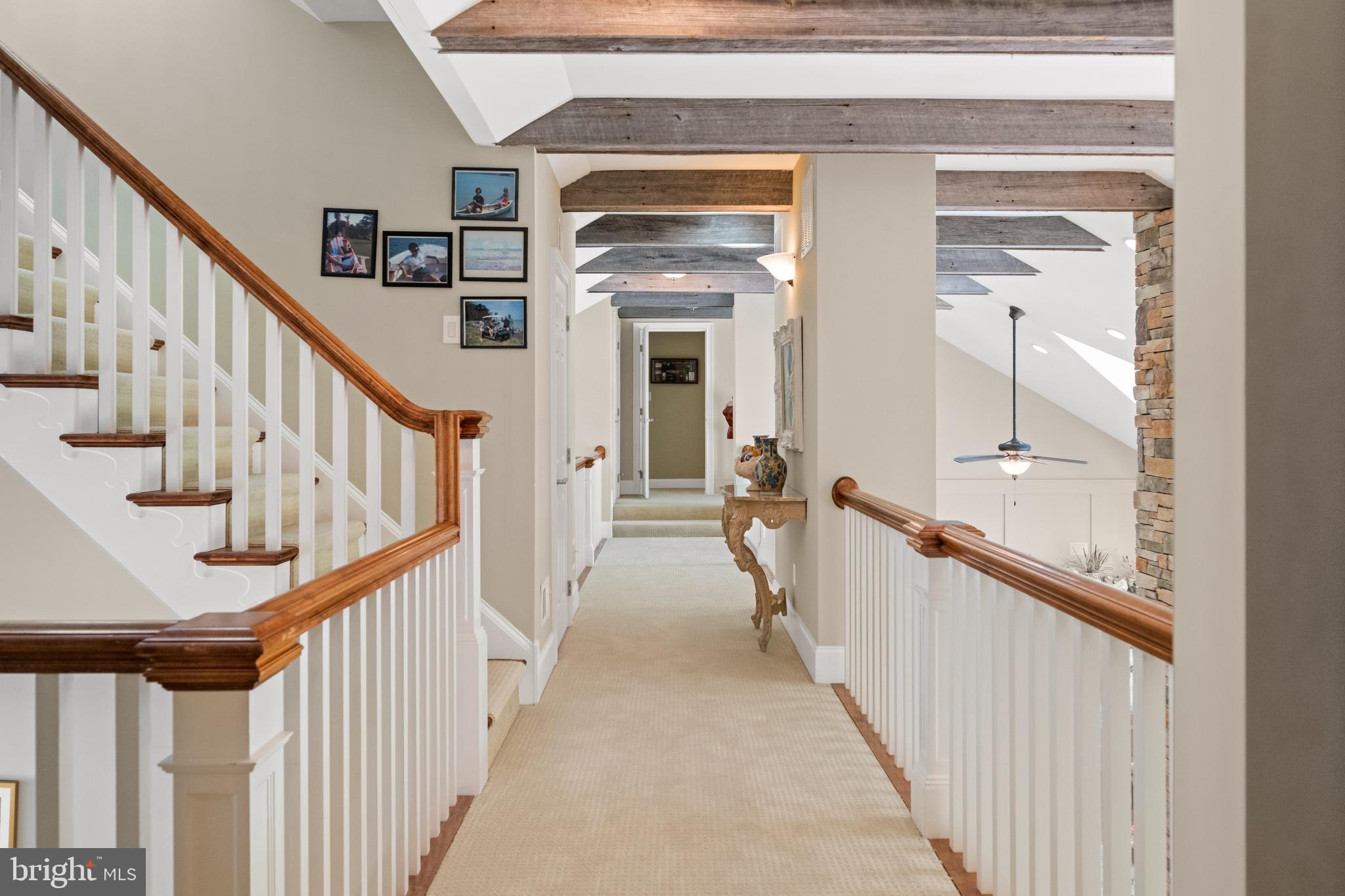 DEEP NECK - Residential