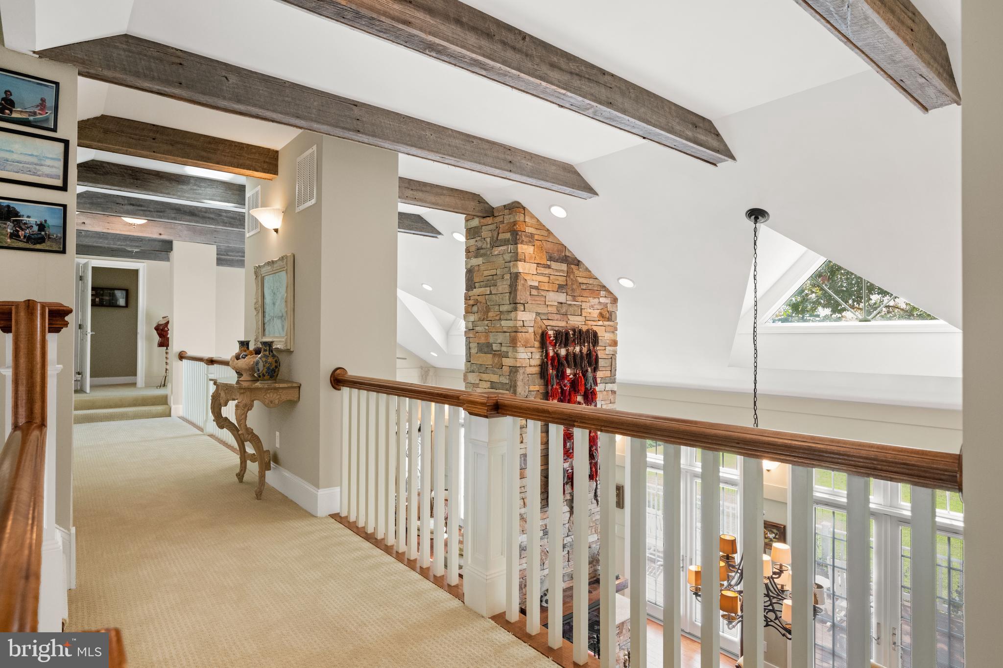 DEEP NECK - Residential