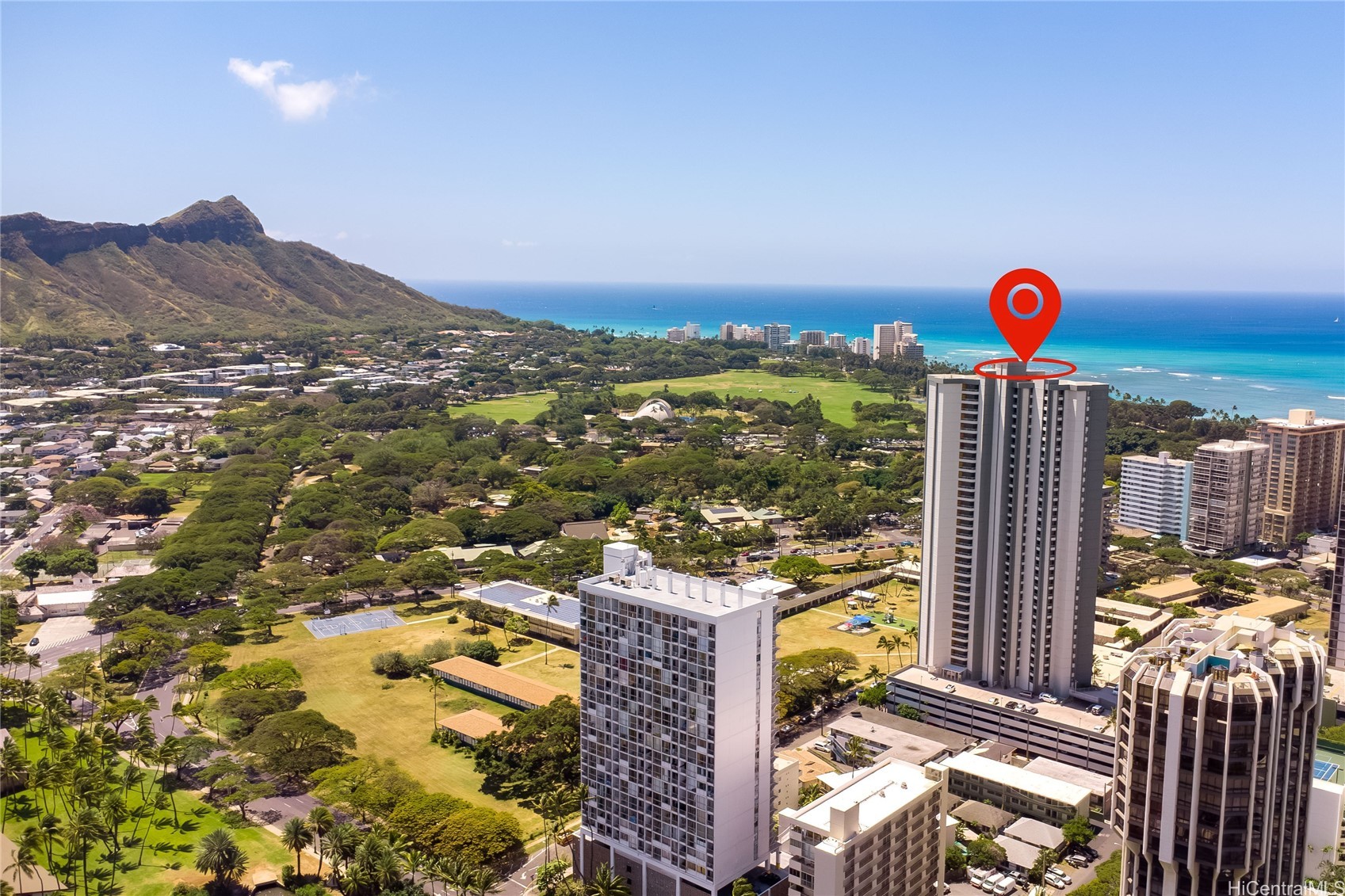 2600 Pualani Way 3102