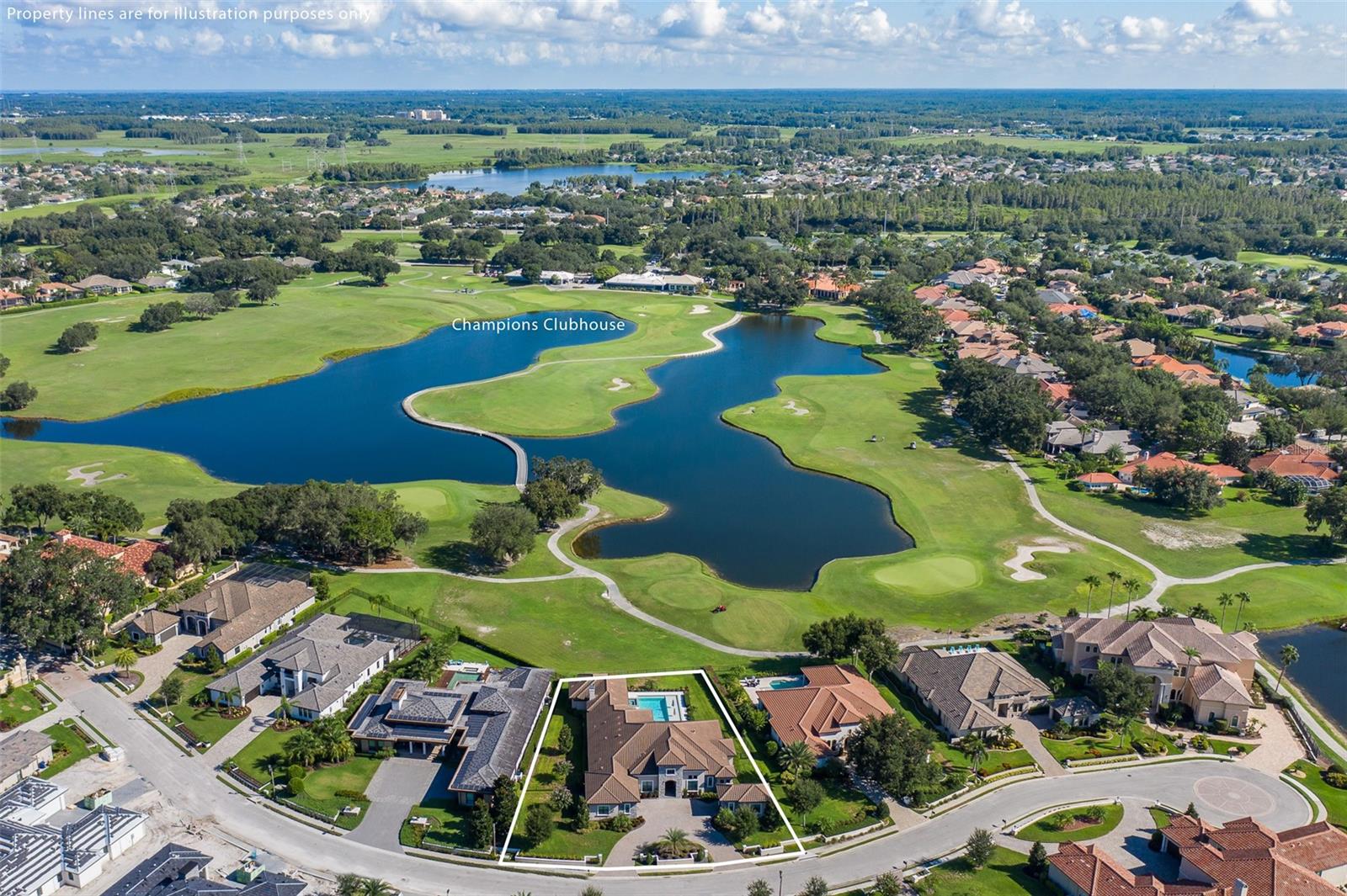 CHAMPIONS CLUB - Residential