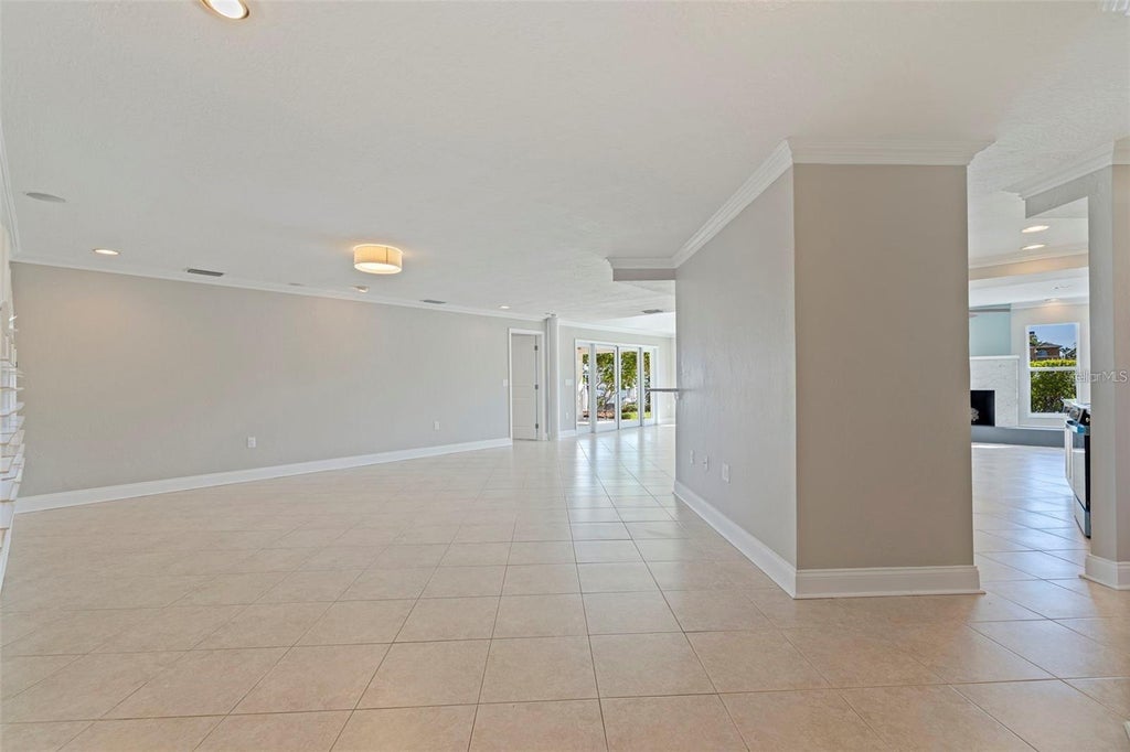 Photo of 11225 4th Street E, Treasure Island, FL 33706 (MLS # TB8545312)