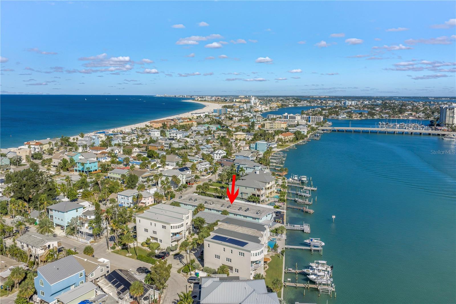 BEACH CLUB AT TREASURE - Residential