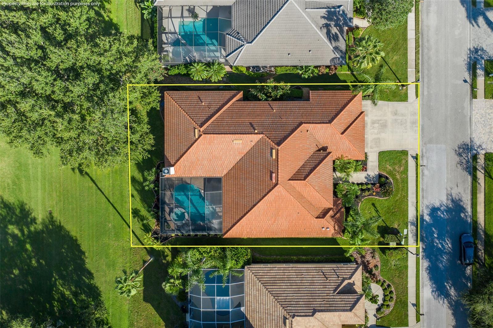 CHAMPIONS CLUB - Residential