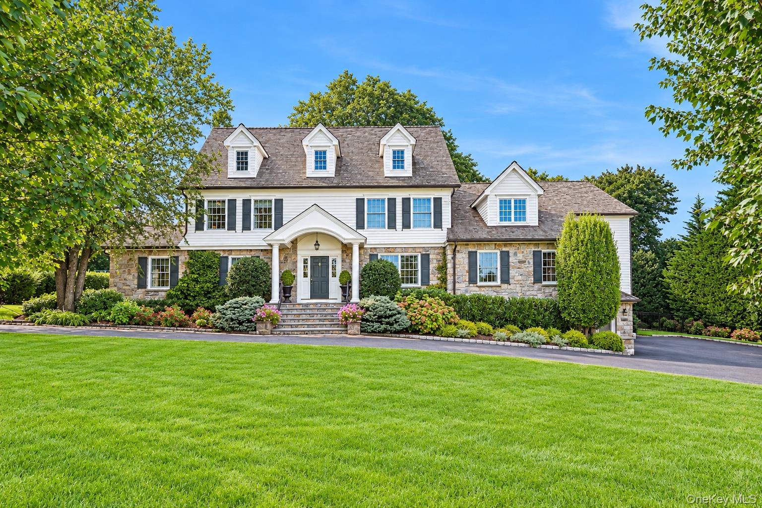 81 Park Drive N