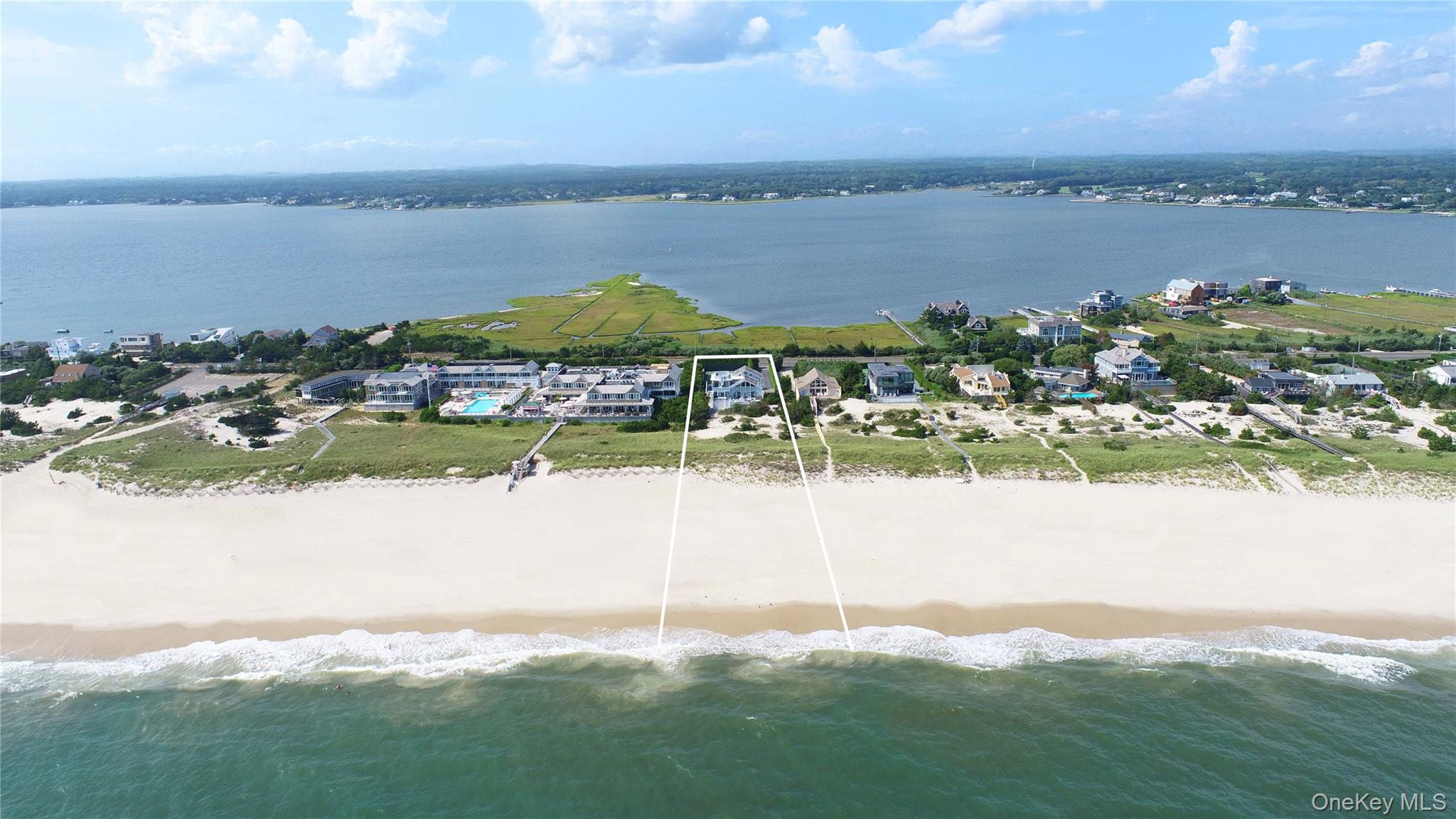 375 Dune Road