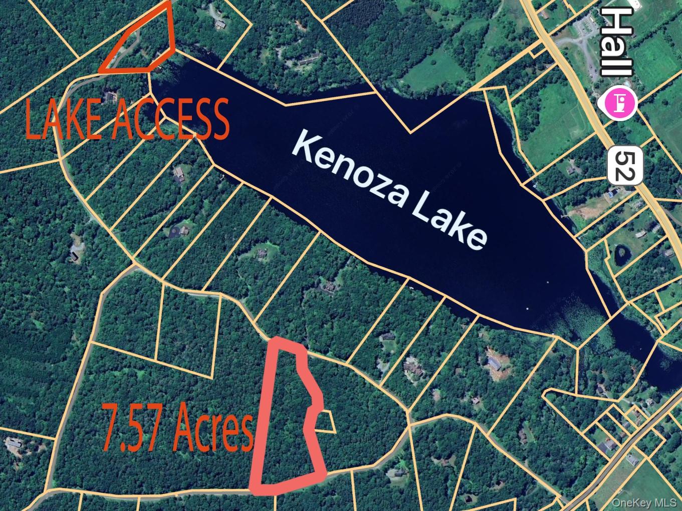 Lot 30 Kenoza Trail