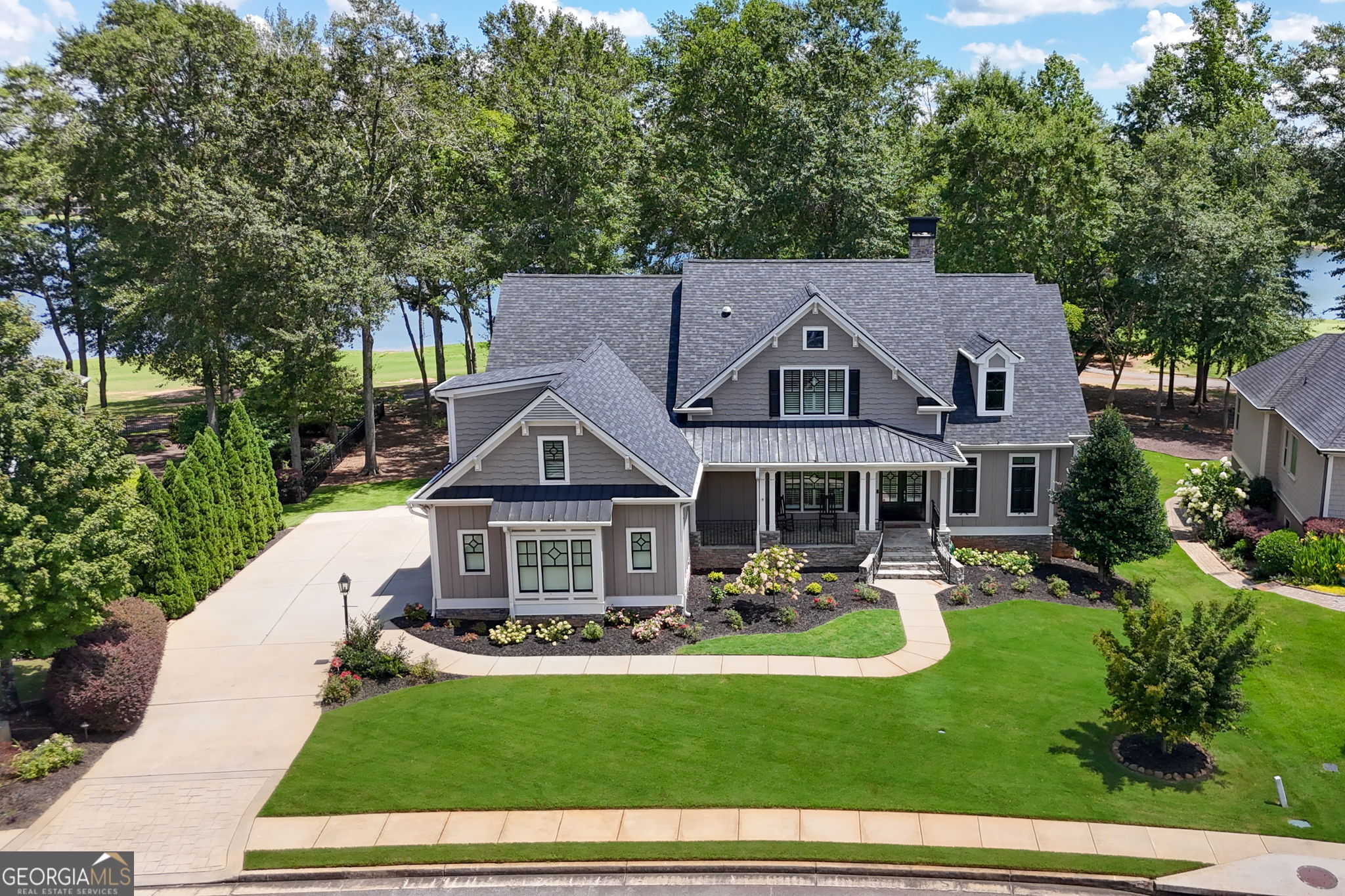 161 Lake Shore DR