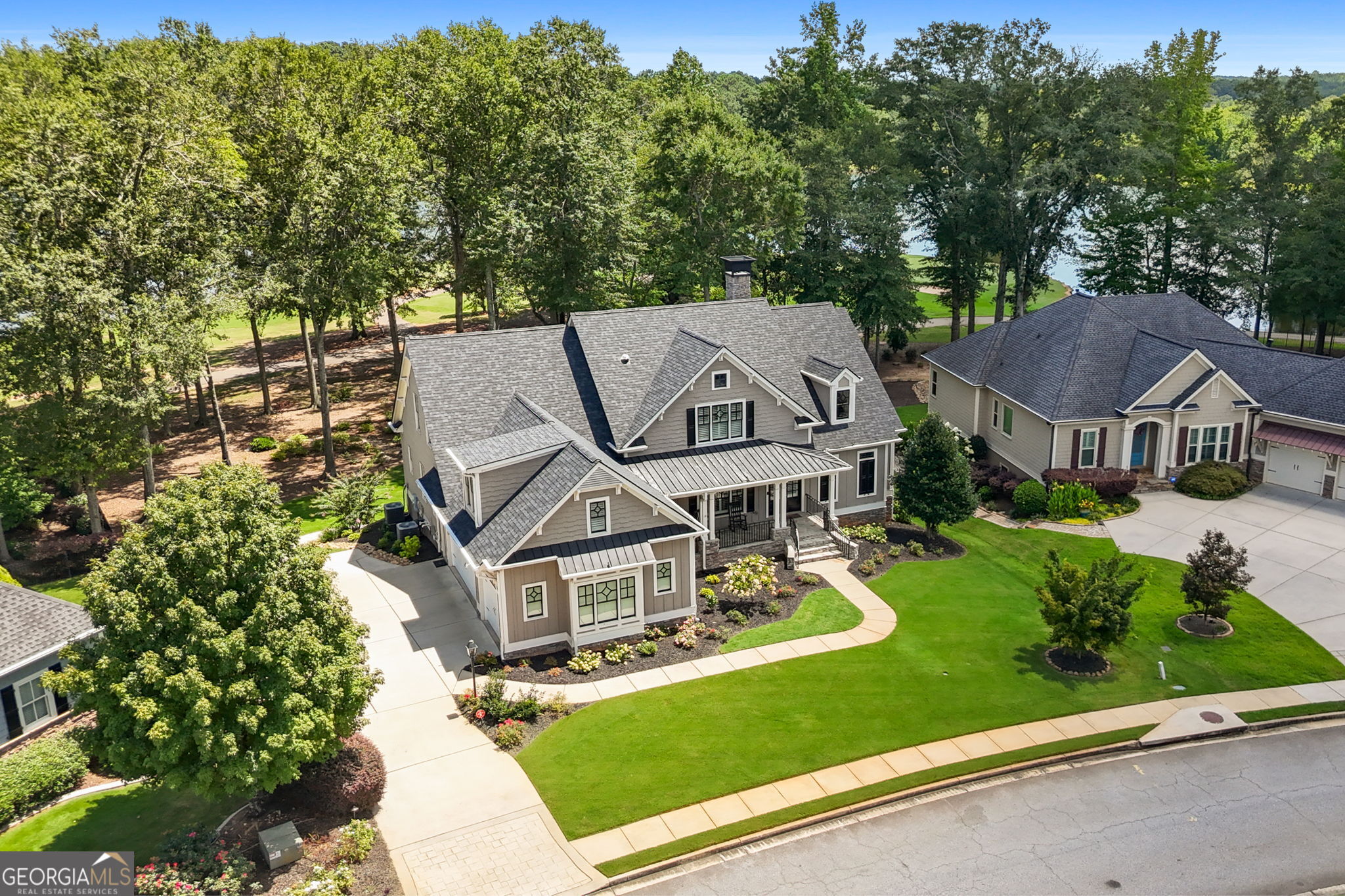 161 Lake Shore DR